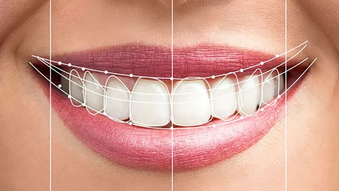 COSMETIC DENTISTRY