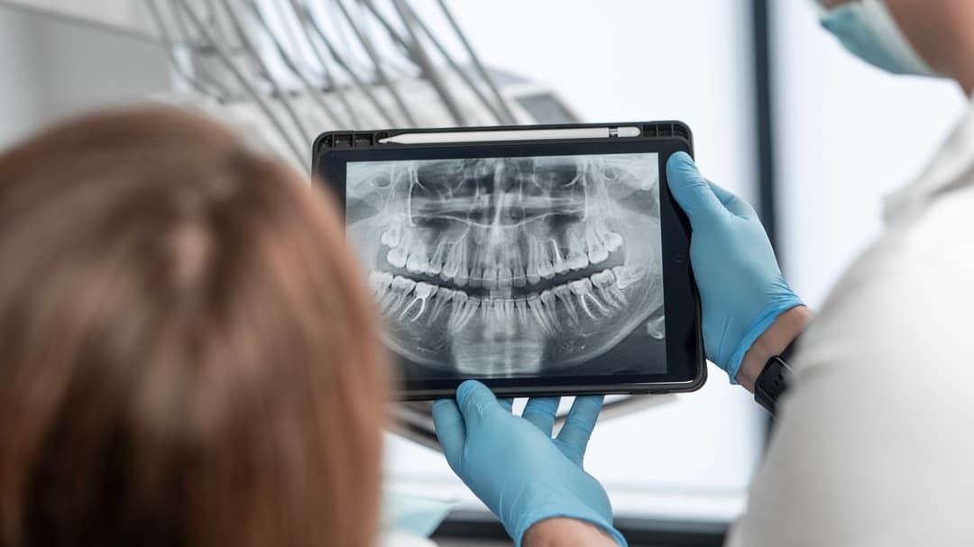 CIRURGIA ORAL